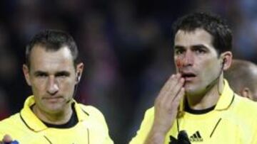 <b>AGRESIÓN. </b>Xavier Aguilar, tras recibir el impacto del paraguas.