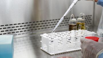 Imagen de archivo de un laboratorio donde se tratan muestras de coronavirus.