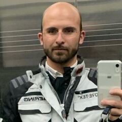 Imanol revela cómo fue para él quedarse calvo desde los 14 años