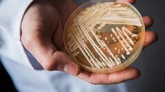 El hongo ‘Candida Auris’ se está convirtiendo en un problema mundial, pero ¿por qué cada vez son más frecuentes estos hongos peligrosos?