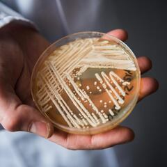 ¿Qué es candida auris, el hongo que Javier Acosta cogió en una piscina y le ha provocado la muerte?