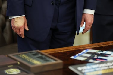 The mystery behind Donald Trump’s hand bruises explained