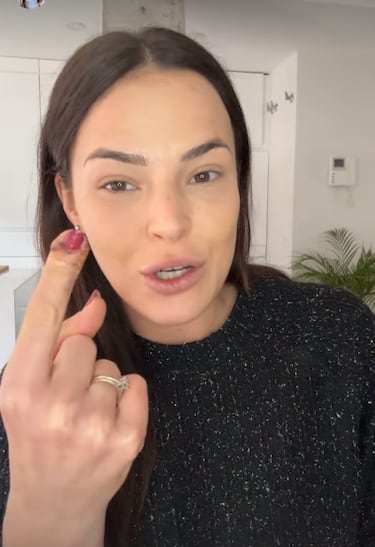 Marta Peñate sufre un accidente doméstico: “No quiero que acabéis vomitando”