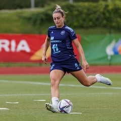 ¿Por qué la lesión de Alexia es más común en mujeres?