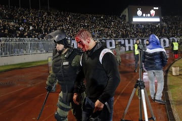 Belgrade derby descends into scenes of bloody violence