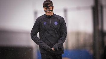 Lewandowski missed Tuesday’s Copa del Rey game against Atlético Madrid because of a eye socket fractured sustained last weekend.