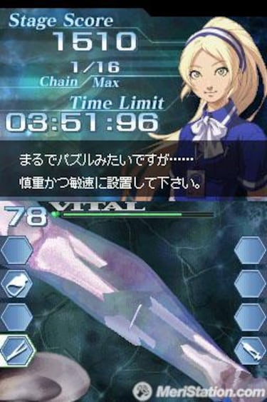 Trauma Center: Under the Knife 2, Impresiones