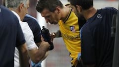 Mandzukic sufre fractura nasal y podría estar de baja dos semanas