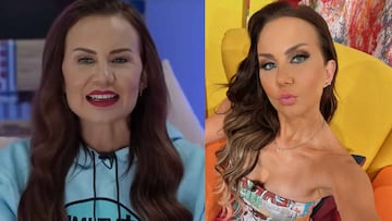 El antes y después de Michelle Vieth.
