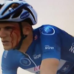 Grivko pegó un codazo a Kittel y le partió una ceja en carrera