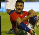 Alexis fue operado y recién volverá a jugar en 2020