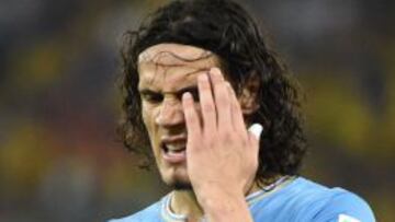 Edinson Cavani.