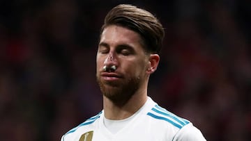 Sergio Ramos con la nariz rota.