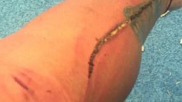 Así salió el Cacha del duelo ente Atlas y Pumas