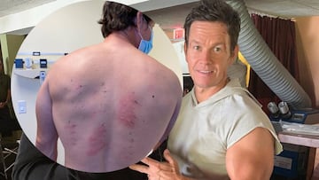El actor Mark Wahlberg descubre a sus 49 años que es alérgico a "casi todo"