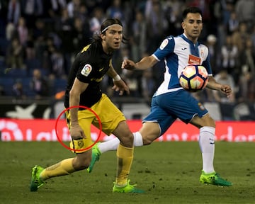 El jugador del Atlético de Madrid jugó el partido de LaLiga frente al Espanyol con un vendaje en su mano derecha.
 