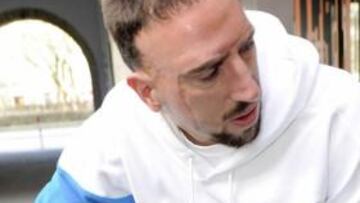 Alivio en el Bayern: Ribery s¨®lo estar¨¢ una semana KO