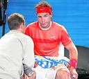 Rafa Nadal tiene "una mínima rotura fibrilar"