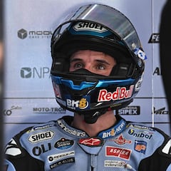 “El esternocleidomastoideo de Álex está áun un poco contracturado”