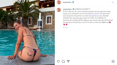 El accidentado verano de Eva Soriano: “Me desperté con ese morado en el orto”