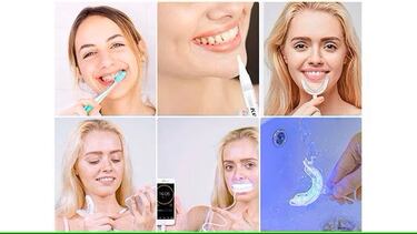Consigue unos dientes blancos con el tratamiento mejor valorado en Amazon