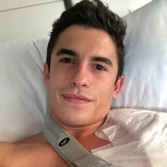 Márquez ya se encuentra mejor tras operarse el hombro