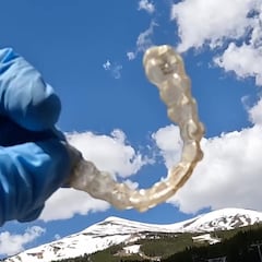 Limpiando la montaña: dentaduras, vapeadores, una piña, salsa BBQ...