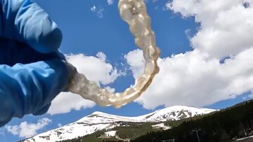 Dentadura en Breckenridge, Colorado