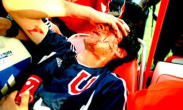 El 31-08-2003, Cristián Thompson jugó su único Superclásico. Y apenas cuatro minutos se demoró en marcar un gol. Fue en un 1-1 que terminó abruptamente a los 55', tras una agresión al azul Nelson Pinto.