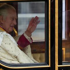 Why does King Charles III have swollen “sausage” fingers?