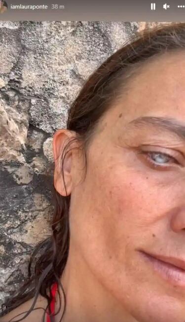 Laura Ponte publica su primera instantánea tras perder la visión de un ojo