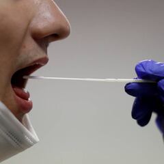 Vigo utiliza los test de saliva que usan en la NBA