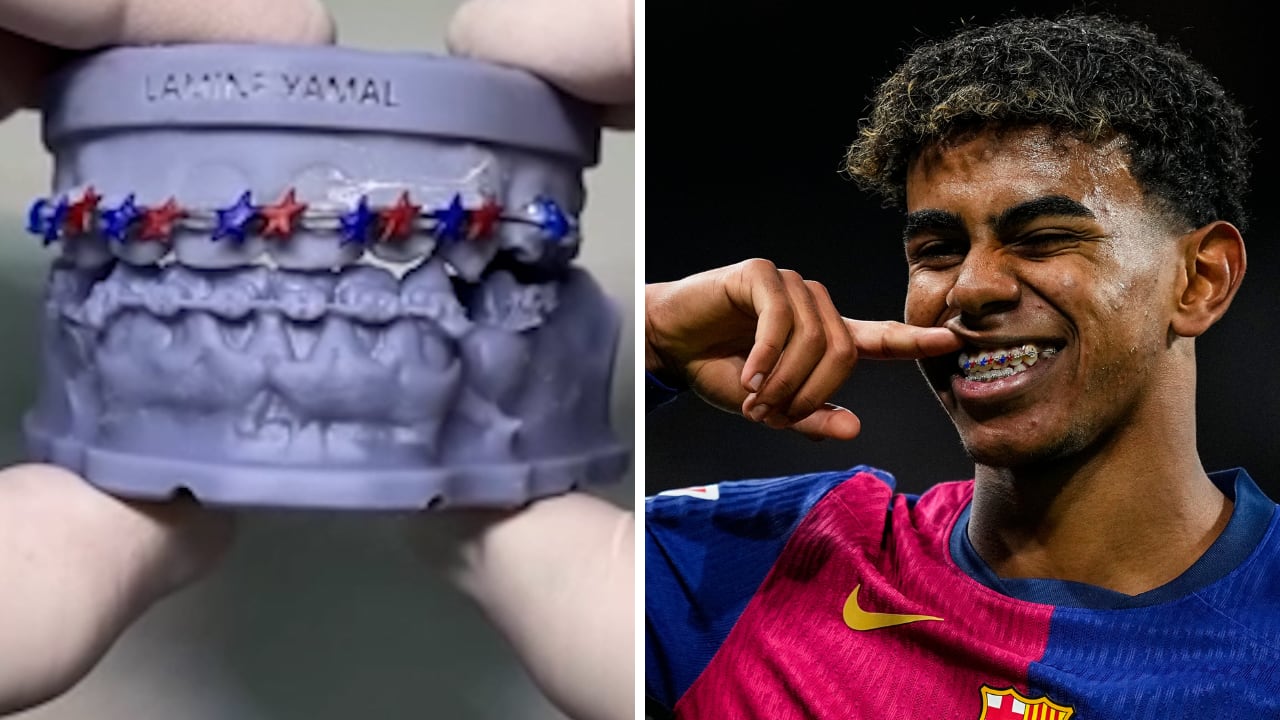 Watch: inside the creation of Lamine Yamal’s special brackets for El Clásico