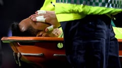 Bravo se lesiona y se perdería el resto de la temporada