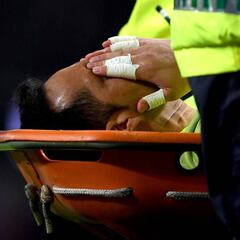 Bravo se lesiona y se perdería el resto de la temporada