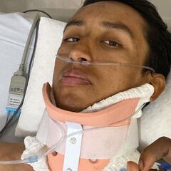 Bernal: "En un 95% podría haber quedado parapléjico"