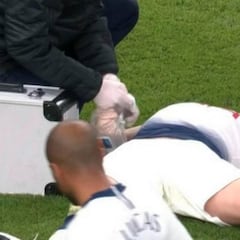 Susto de Vertonghen: se fue mareado tras un golpe en la cabeza que le hizo sangrar