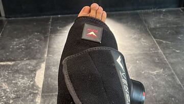 Rodrygo colg&oacute; en Instagram la imagen de su pie golpeado.