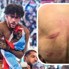 Así quedó la espalda de Bad Bunny tras ganar a Damian Priest