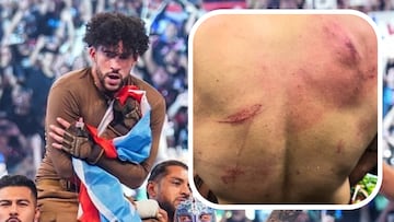 Bad Bunny, durante su combate en WWE Backlash y las heridas en la espalda que sufri¨® durante el mismo.
