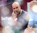Guardiola se queja y le llueven las críticas: “Somos el equipo más corto de la Premier”
