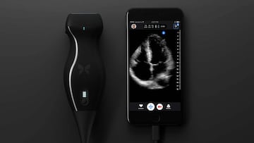 Butterfly iQ, el aparato médico que hace ecografías en el momento