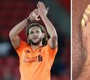 Lallana muestra sus pies congelados y pide ayuda