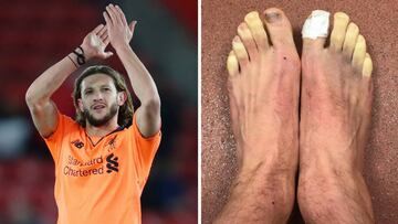 Adam Lallana y sus pies cogelados tras el Southampton-Liverpool.