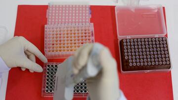 FILE PHOTO: An employee dilutes poultry serum samples for ELISA test for the detection of antibodies to the avian influenza virus at the Reference Laboratory of the World Organization for Animal Health in Campinas, Brazil April 25, 2023. REUTERS/Amanda Perobelli/File Photo