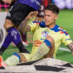 Las lesiones de América ante Monterrey