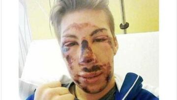 Thomas Diethart subi&oacute; una imagen de sus heridas en el hospital. 