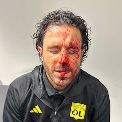 Incomprensible decisión en Francia: el Marsella-Lyon, en el Velodrome y con público