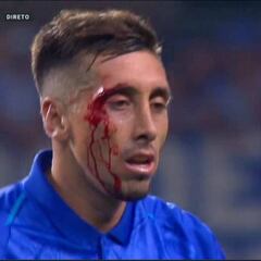 Apenas se operó y ya estrenaron a Héctor Herrera