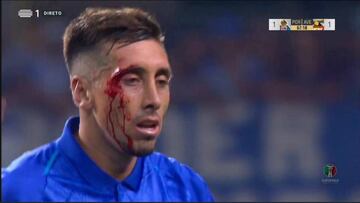 El futbolista mexicano recientemente se sometió a algunas cirugías y en el primer partido oficial del Porto sufrió un duro impacto en la cara.